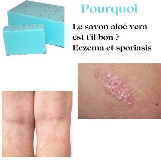 JABON ESPORIASIS CON ALOE VERA 100G